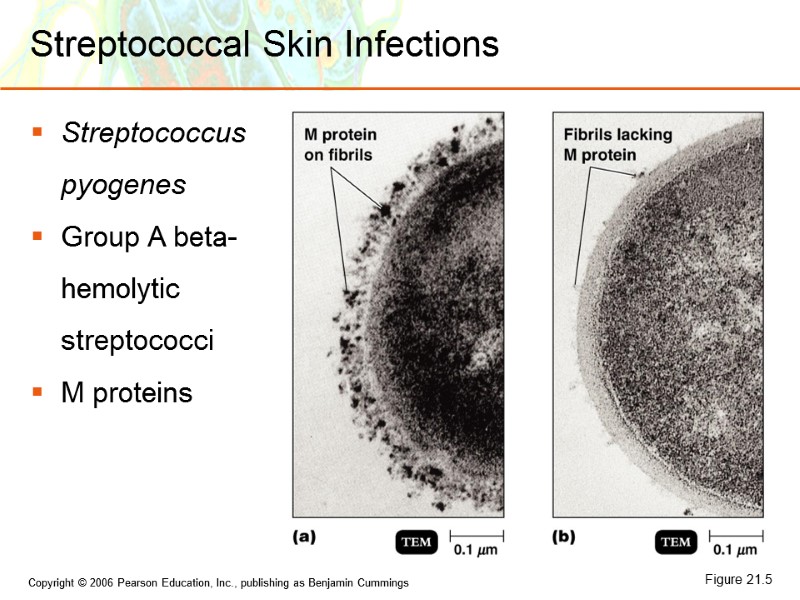 Streptococcal Skin Infections Streptococcus pyogenes Group A beta-hemolytic streptococci M proteins Figure 21.5